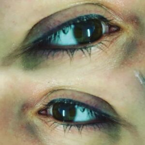 Top Liner and Bottom Liner